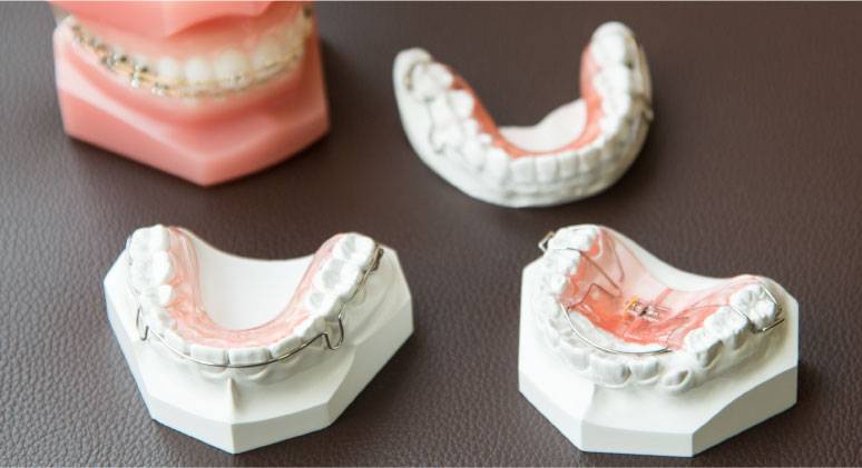 矯正歯科治療とは